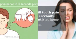 kill-tooth-pain-nerve-in-3-seconds-permanently-1786975741627
